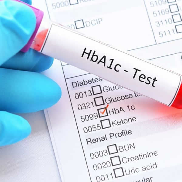 Seaview Pharmacy | HbA1c Testing